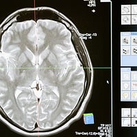 马斯克的脑机接口公司Neuralink获准启动人体临床试验_维持目标价170美元